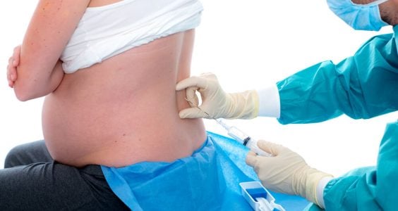 Epidurální analgezie