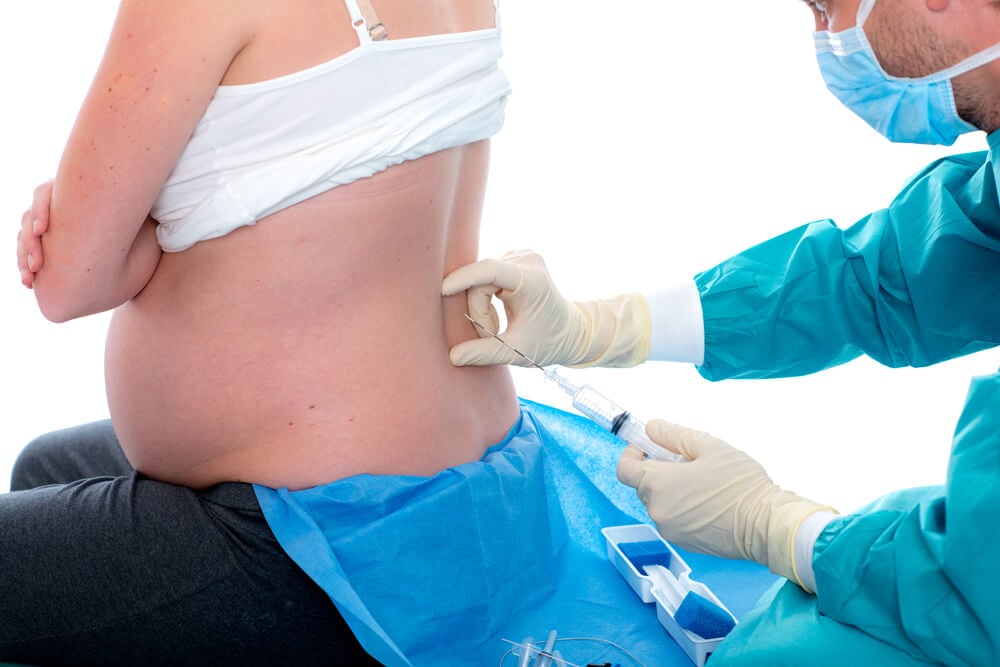 Epidurální analgezie