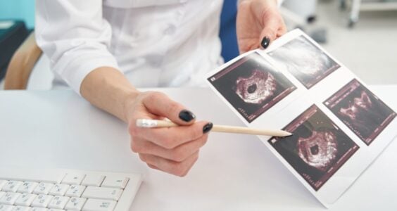 První Trimestr těhotenství ultrazvukové vyšetření