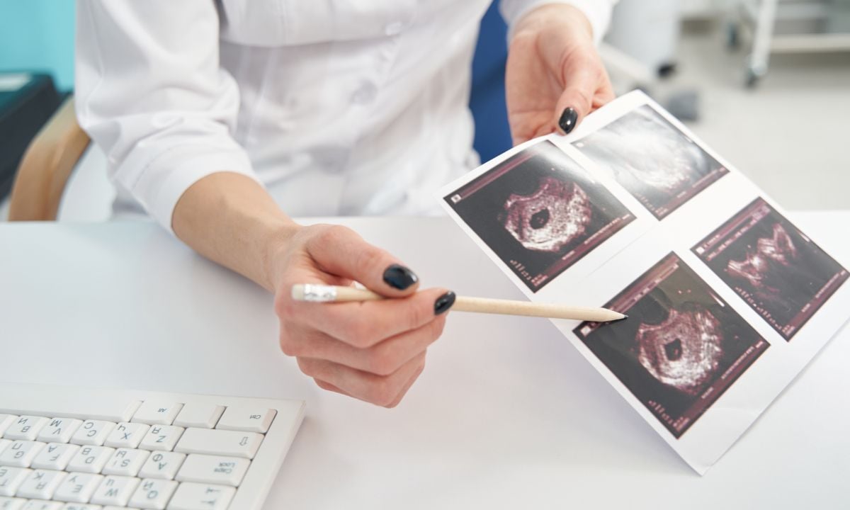 První Trimestr těhotenství ultrazvukové vyšetření