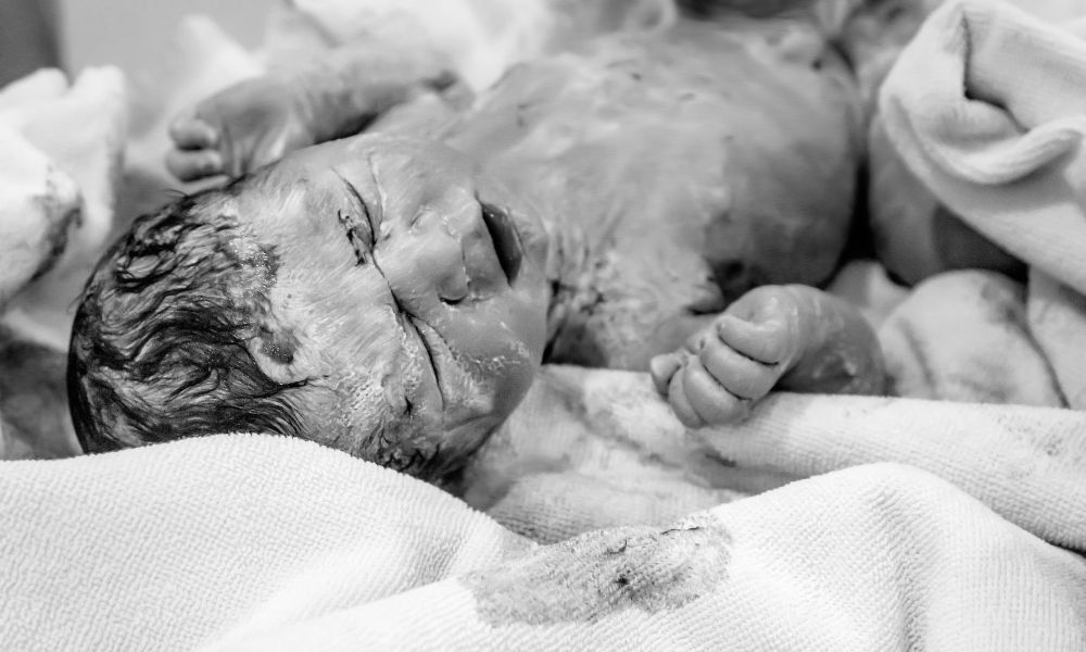 Vernix caseosa u novorozence